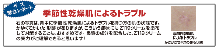 緊急レポート,Z119クリーム｜男性化粧品・メンズコスメ通販のザス-zas　
