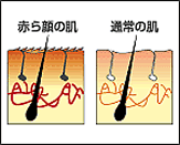 赤ら顔の肌・通常の肌｜男性化粧品・メンズコスメ通販のザス-zas