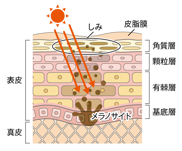 肌の構造としみ