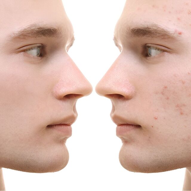 スキンケア講座,メンズコスメ, 男性化粧品通販｜ザスインターナショナル