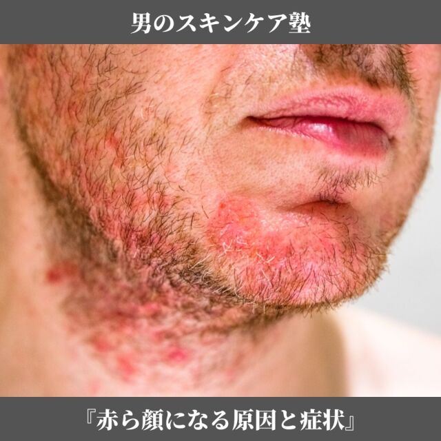 スキンケア講座,メンズコスメ, 男性化粧品通販｜ザスインターナショナル