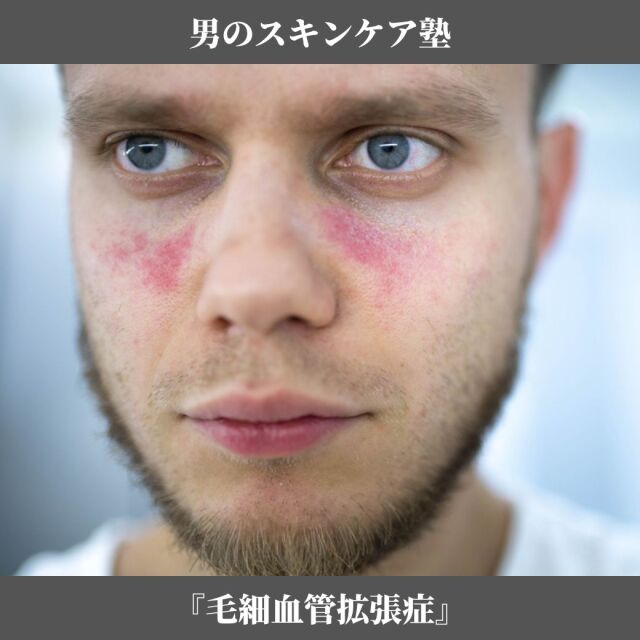 スキンケア講座,メンズコスメ, 男性化粧品通販｜ザスインターナショナル