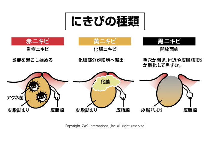 スキンケア講座,メンズコスメ, 男性化粧品通販｜ザスインターナショナル