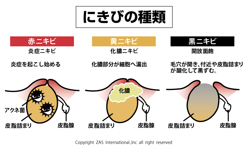 スキンケア講座,メンズコスメ, 男性化粧品通販｜ザスインターナショナル