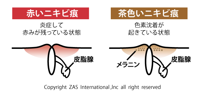 スキンケア講座,メンズコスメ, 男性化粧品通販｜ザスインターナショナル