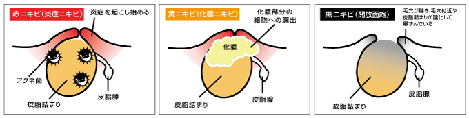 スキンケア講座,メンズコスメ